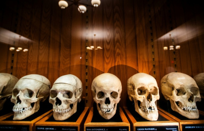 Skulls from the Josef Hyrtl Collection at the Mutter Museum, in Philadelphia, Pennsylvania - Matthew Hatcher (AFP)